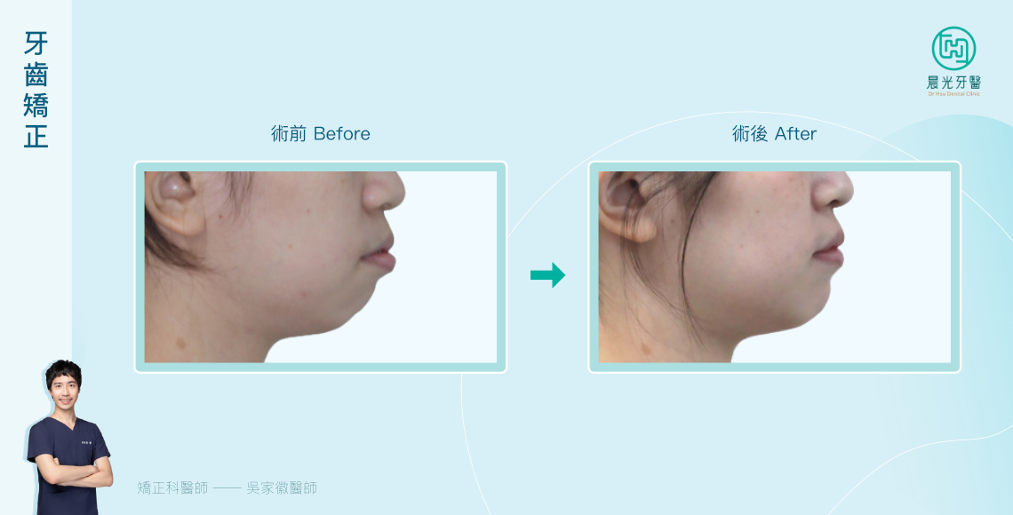 改變從「咬」開始！